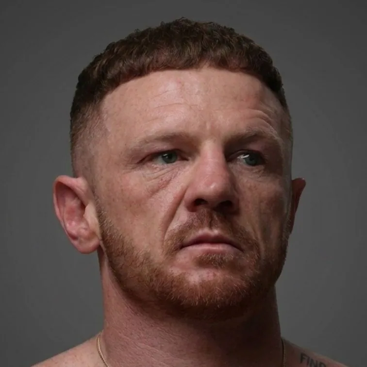 Luke Jackson six months after his hair transplant, front view