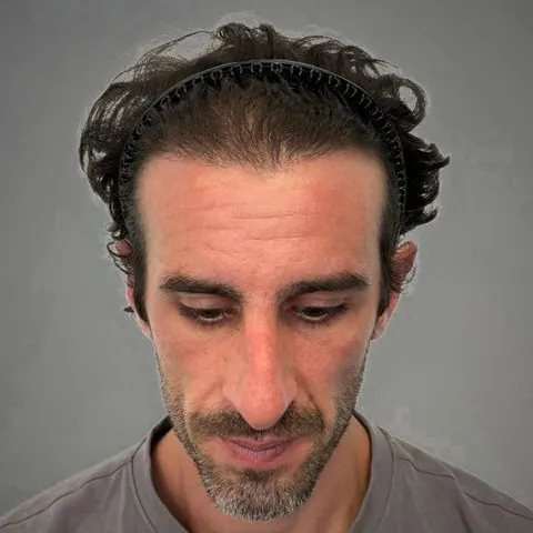 After, Damien, front view